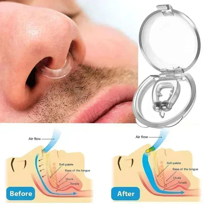 Anti-Snoring Ring